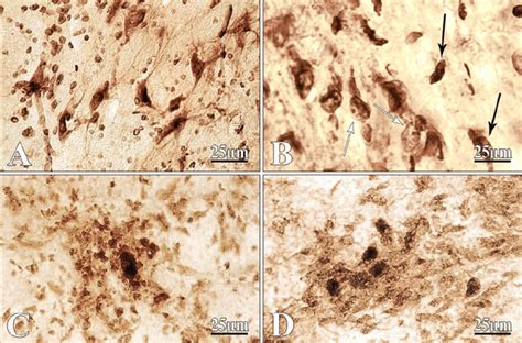 Frontal Slices Of Nucleus Basalis Of Meynert Neurons In Normal