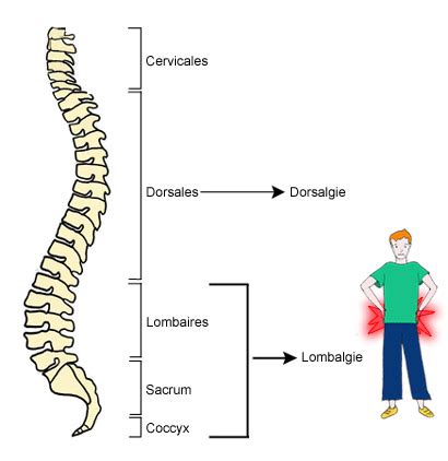 Lombalgie D Finition Sympt Mes Et Traitements