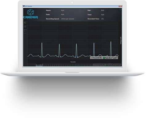 Dynamic Wpf Visualization Of Ecg Signals In Realtime Scichart