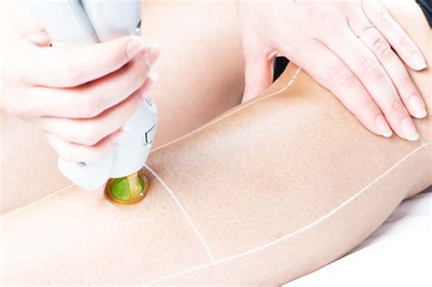 Epilation laser Lieusaint Senart Dr Céline Grégoire