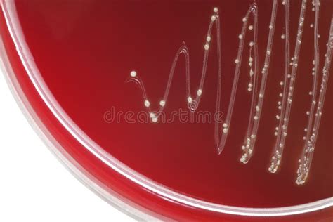 Estreptococo Colonias Bacterianas Con Hemolítico Beta En Sangre AG