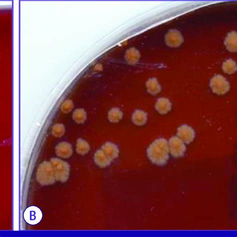 Colonies On Blood Agar Showed Small Orange Colored Convex Colonies