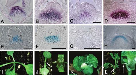 Gene Expression Patterns In Drn D Mutants And Double Mutant Analysis