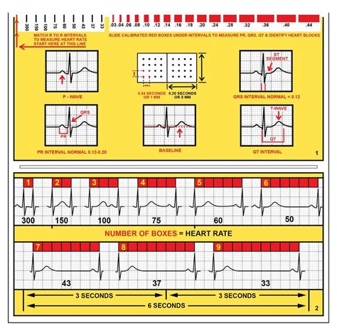 R Cat For Arrhythmias Ekg Pocket Reference Guide Great Study Card For