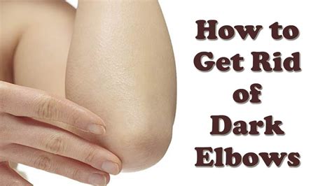 How To Get Rid Of Bone Spur In Elbow Bone Spurs Of The Elbow