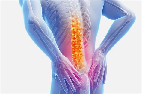 Understanding the Anatomy of Nerve Pain | PainScale