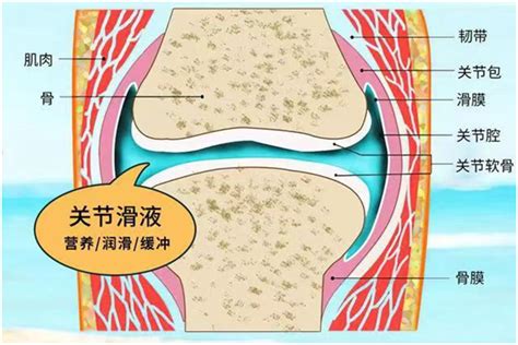 三分钟带你了解膝关节积液！ 德医学院 助力医学教育发展！