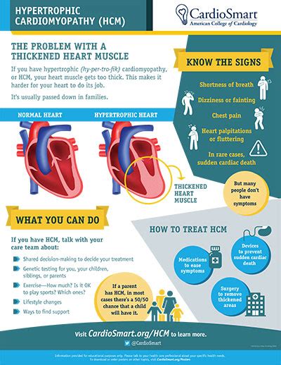 Signs and Symptoms| Hypertrophic Cardiomyopathy | CardioSmart – American College of Cardiology