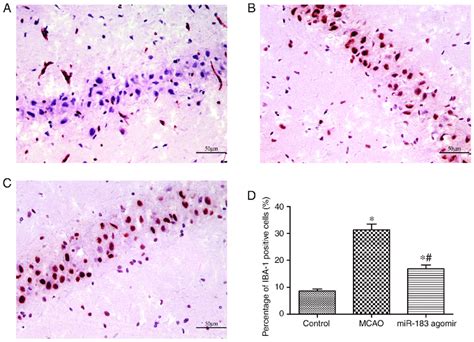 Evaluation Of Iba Positive Cells By Immunohistochemistry