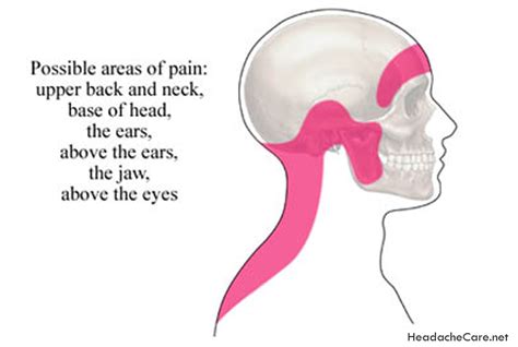 Tips On How To Handle and Treat Sinus Headache Symptoms