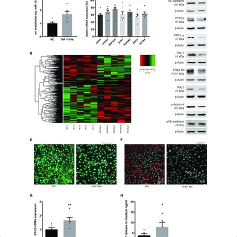 Mir 125a Expression Upon Inflammatory Stimulation Of Huvec And Its