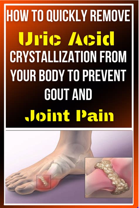 How To Quickly Remove Uric Acid Crystallization From Your Body To