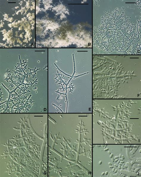 Trichoderma Gillesii Anamorph A B Pustules C I Conidiophores Hairs