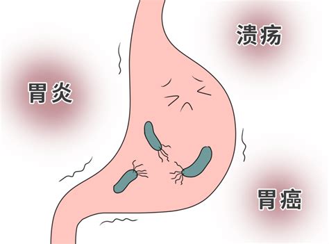 合卫顺：幽门螺杆菌 预防清除 手册 合卫顺官网