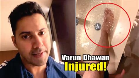 Varun Dhawan Injured Varun Dhawan Suffers Foot Injury On Atlee S Vd