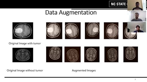 Brain Tumor Detection Using Convolutional Neural Network Youtube