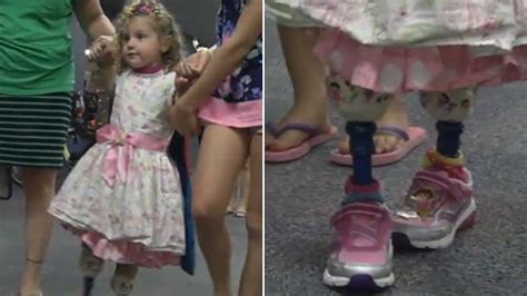 2 Year Old Takes Inspiring First Steps After Tragic Lawnmower Accident Fox31 Denver