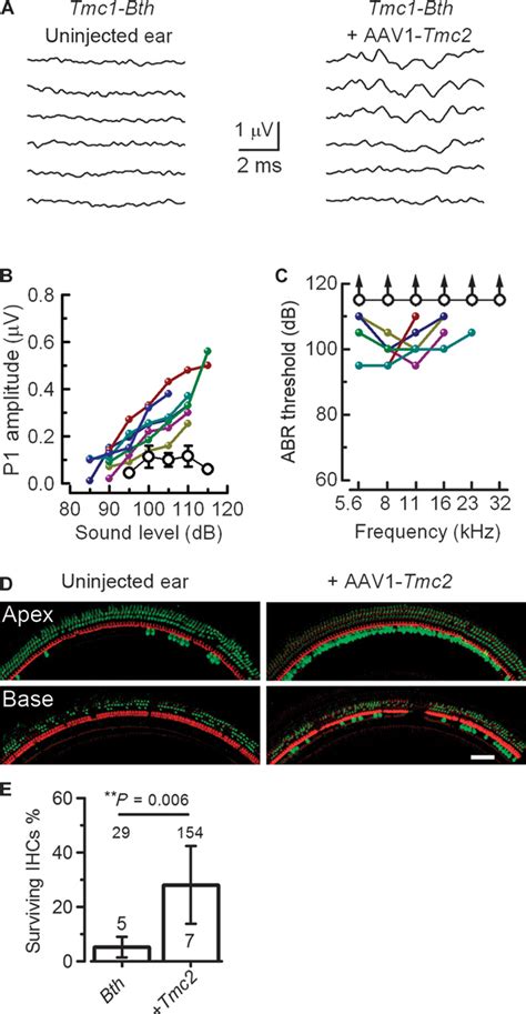 Tmc Gene Therapy Restores Auditory Function In Deaf Mice Science