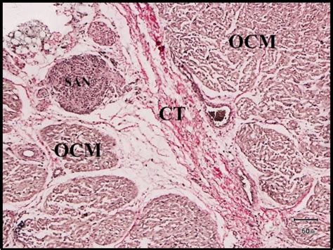 SA Node Histology