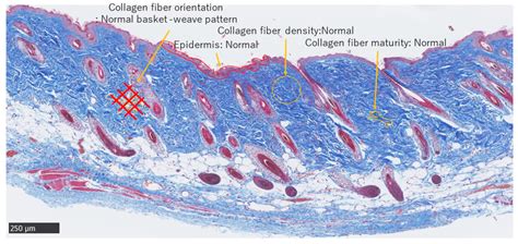Masson Trichrome Staining Normal Adult Skin Scale Bar M