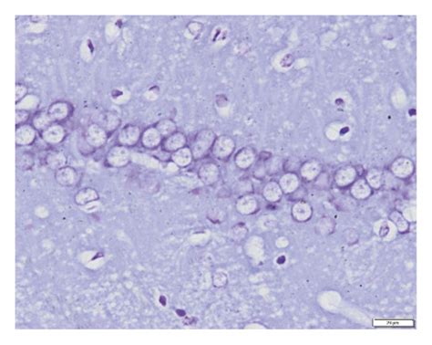 Nissl Staining Showing The Effects Of SK On Neuronal Morphology In