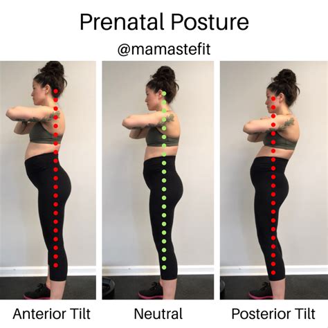 Diastasis Recti In Pregnancy Core Dysfunction Series Part 2