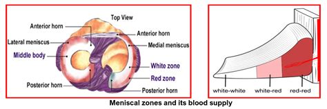 Meniscus Injuries And Management Home Consultant Orthopaedic Surgeon