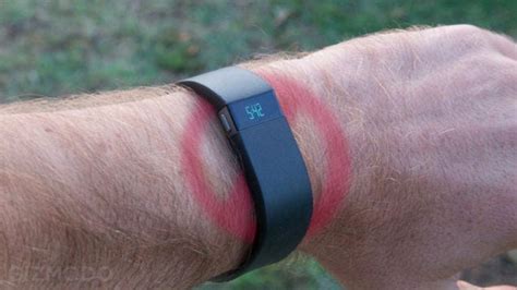 Are We Doomed To Get Rashes From Our Fitness Trackers