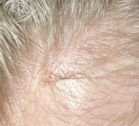 red, itchy spots on my scalp : r/HaircareScience