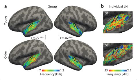 Tonotopic Maps Best Frequency Maps Were Derived By Marginalizing