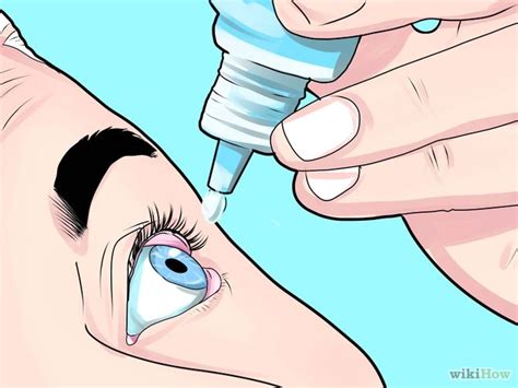 4 Ways To Treat A Stye Wikihow