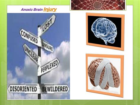 Ppt Anoxic Brain Injury Powerpoint Presentation Free Download Id 272469