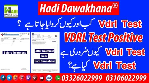 Vdrl Tpha Positive Kya Hota Hai Vdrl Blood Test For Syphilis In