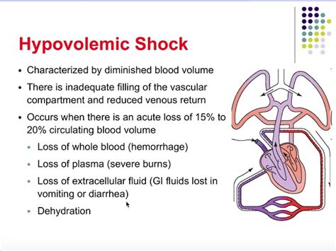 Hypovolemic Shock Pathophysiology