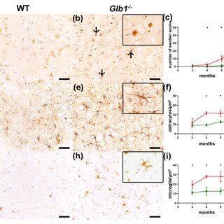 Axonal Alterations Astrogliosis And Microgliosis In Glb Mice