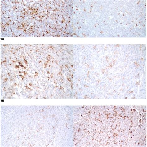 Immunohistochemical Results A Cd163 Right Showed Lower Staining Download Scientific Diagram