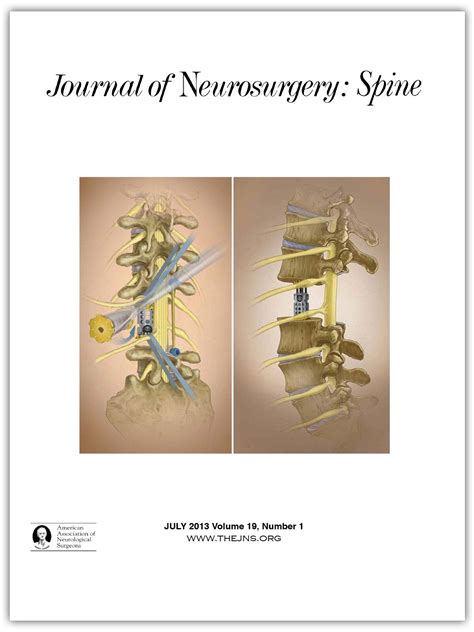 Letter to the Editor: Thoracic fracture-dislocations in: Journal of