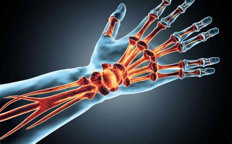 "Ulnar Wrist Pain: Causes, Symptoms, Diagnosis, Treatment" | Doctors ...