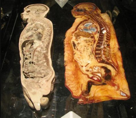 Cross Section Of 2 Human Males One Obese And The Other Fit 9gag