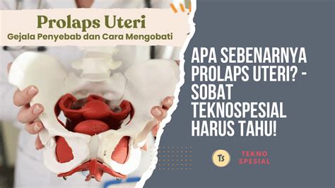 sebenarnya prolaps uteri sobat teknospesial  tahu tekno
