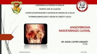 Angiofibroma Nasofaringeo Juvenil PPT