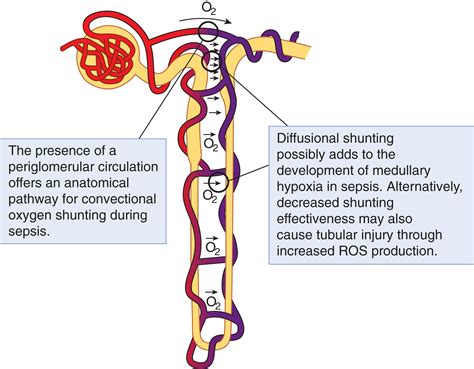 Renal Perfusion In Sepsis From Macro To Microcirculation Kidney