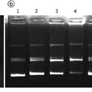 Agarose Gel Electrophoresis Pattern For The Cleavage Of Supercoiled