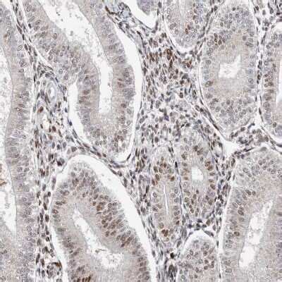 KLF7 Antibody NBP1 80638 By Novus Part Of Bio Techne