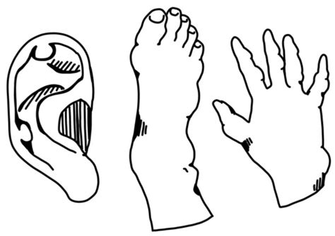 Free Vectors | Gouty tophi hand foot ear line drawing