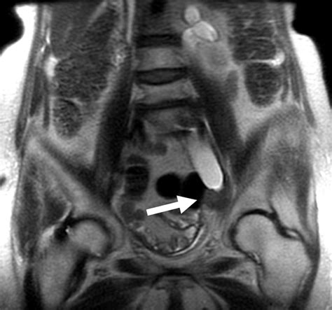 Mr Urography Techniques And Clinical Applications Radiographics