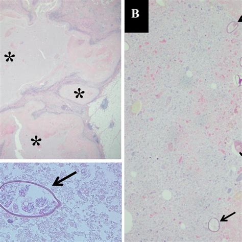 Histological Specimen Hande Stain A On Low Power × 125 Image