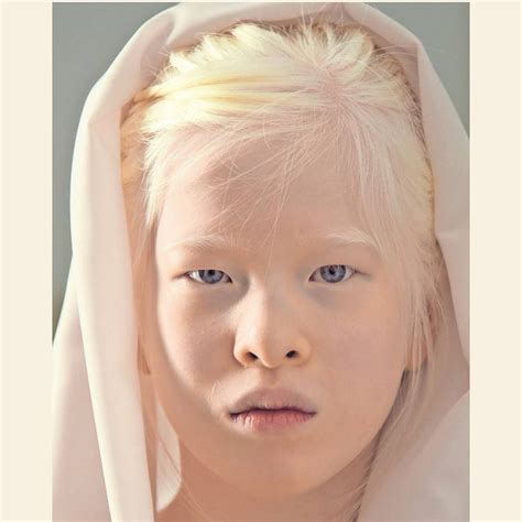 Albinism nude 62 фото