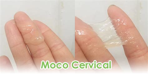 Moco Cervical Verde Test Embarazo