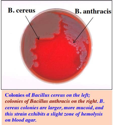 Bacteriology Bacillus Flashcards Quizlet